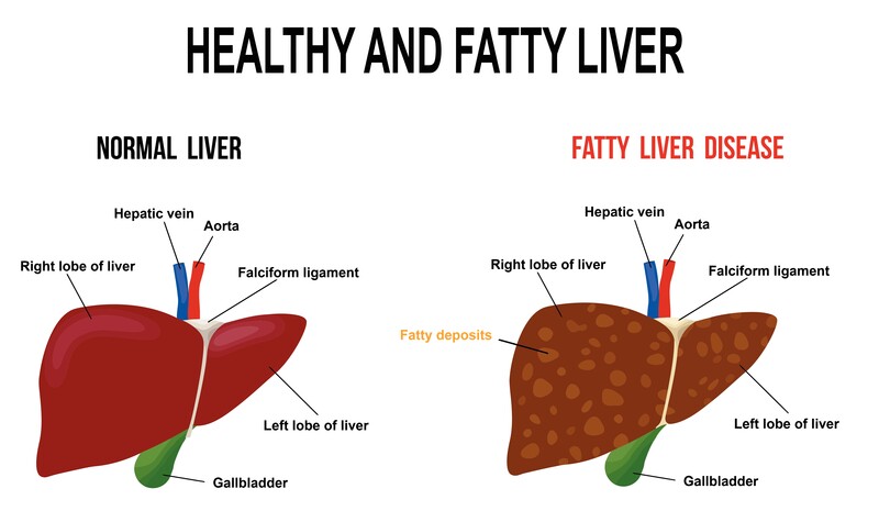 Common vegan diseases and how to easily avoid them